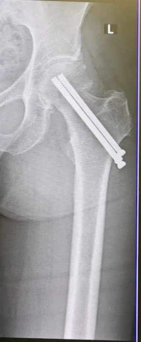 Injury Lawyers of NJ - Zammitti Shaw & Breen Picture 8
